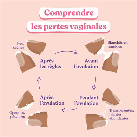 pertes blanche cremeuse|Comprendre les différents types de pertes blanches